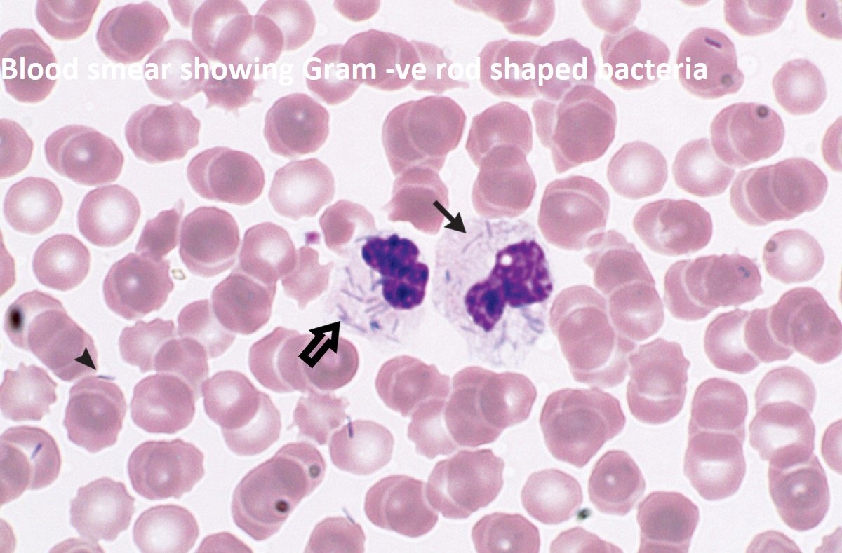 Clinical MCQ 9