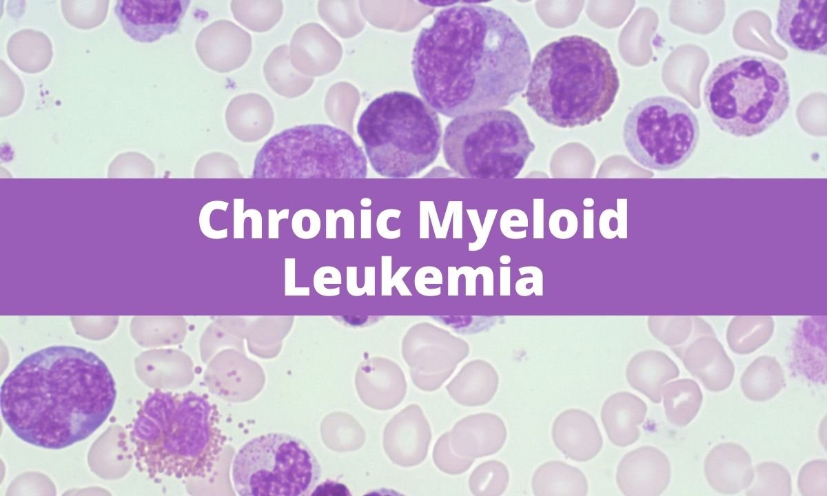 Chronic Myeloid Leukemia Cml Medical Junction