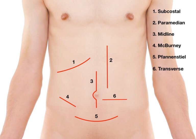 Is It Normal For The Area Around An Incision To Be Red