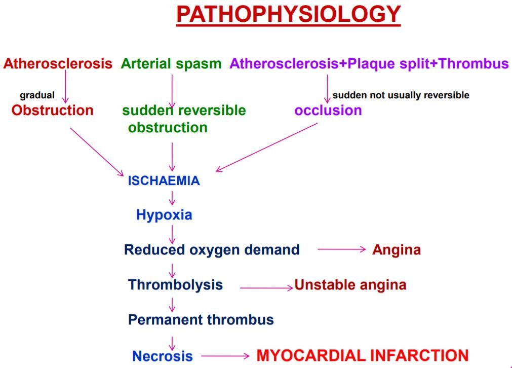 Acute Myocardial Infarction Pathophysiology
