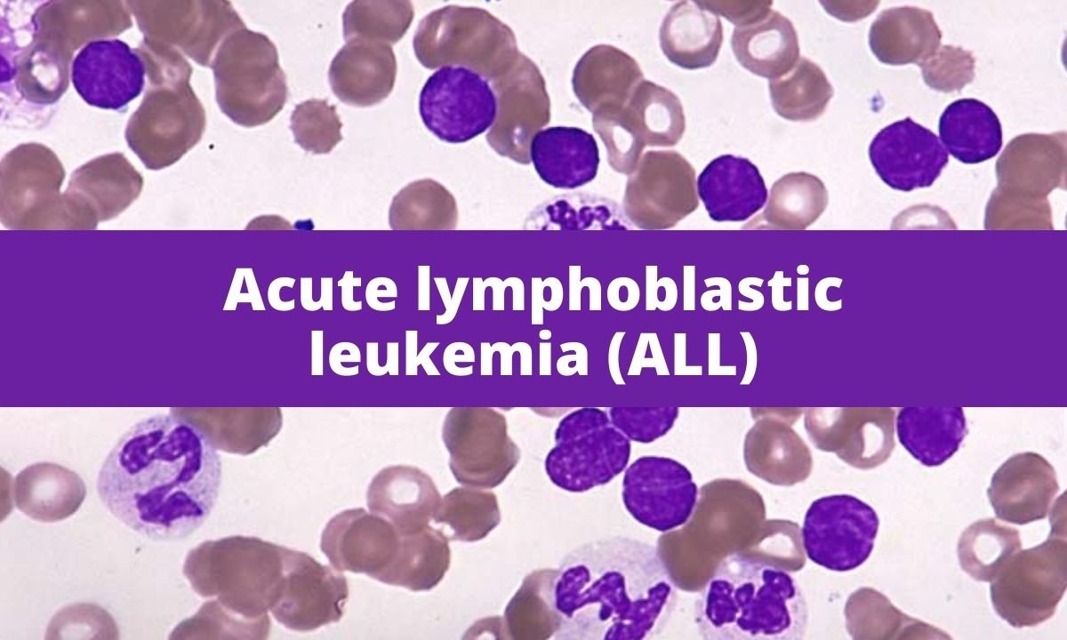 case study acute lymphocytic leukemia