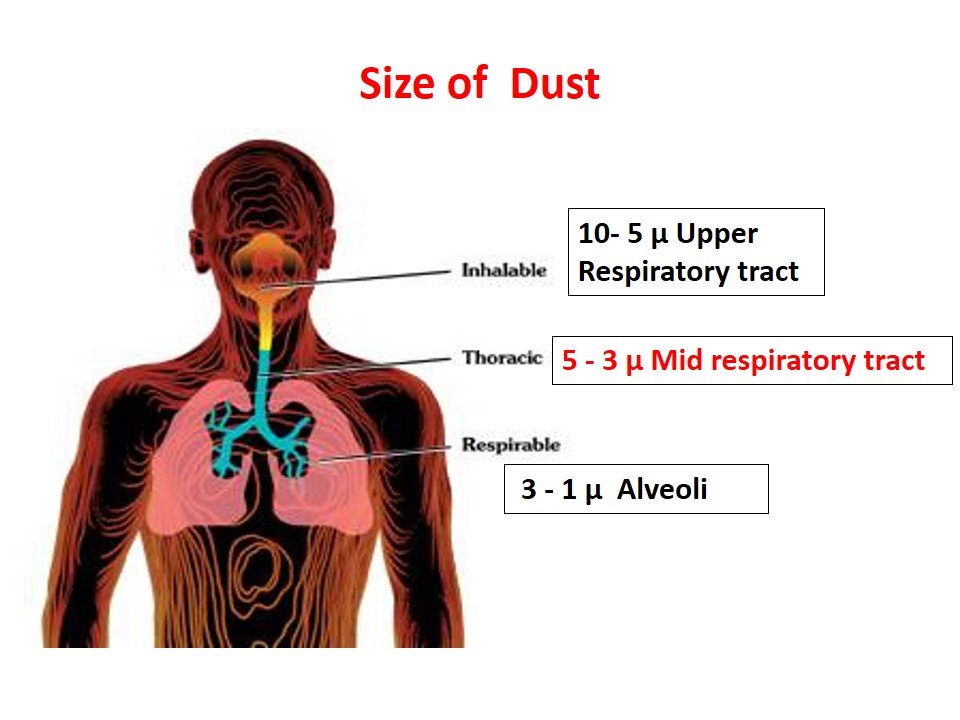 Pneumoconiosis Medical Junction