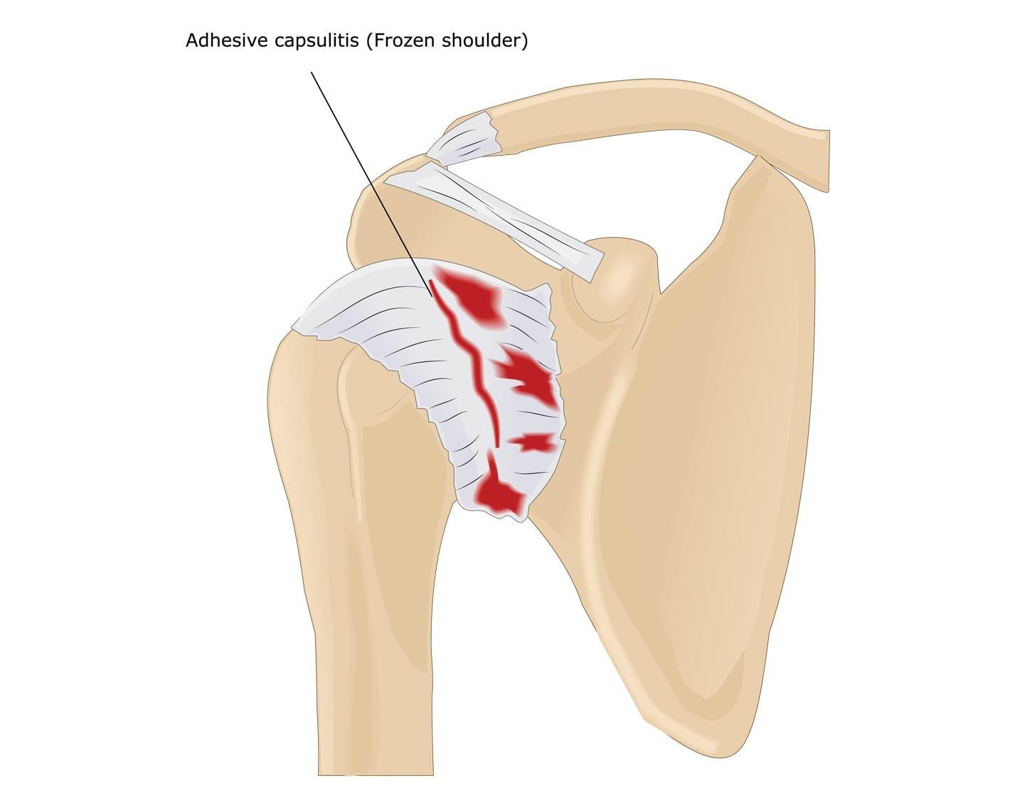 Shoulder Joint Medical Junction 4068